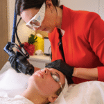 pigmentation removal tullamarine